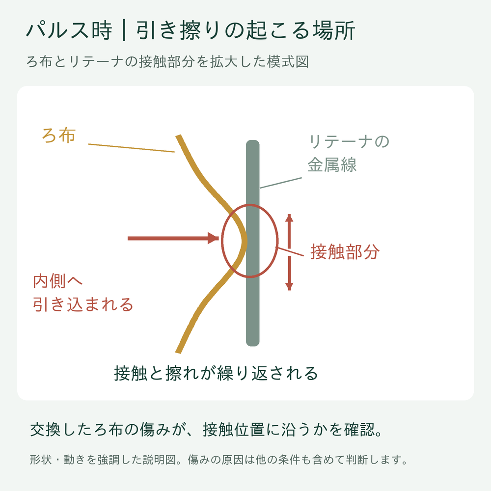 ろ布がリテーナの金属線へ引き込まれ、接触と擦れを繰り返す部分の拡大模式図